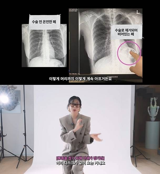 ▲ 출처| 이혜영 유튜브 채널 캡처