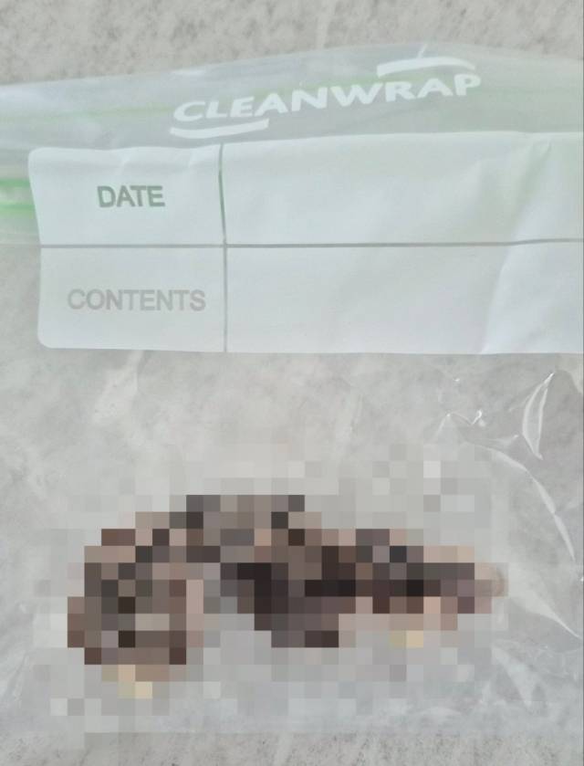 조 모씨가 지난 6월 18일 자궁근종 수술을 받은 뒤 수술 부위에서 심한 악취와 평소와 다른 분비물이 계속되자 지난 7월 23일 직접 체내를 확인하는 과정에서 4㎝×4㎝ 크기의 의료용 거즈를 발견했다. 독자 제공
