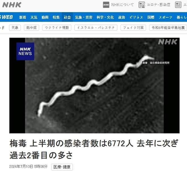일본 NHK 2024년 매독 증가 관련 보도 캡처