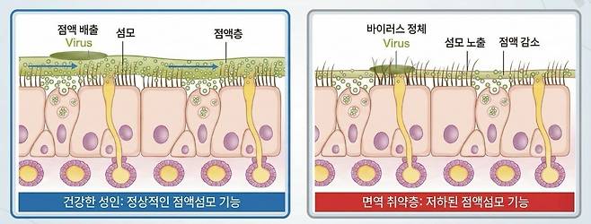 코 점막의 점액·섬모 작용 원리|출처: 하이닥