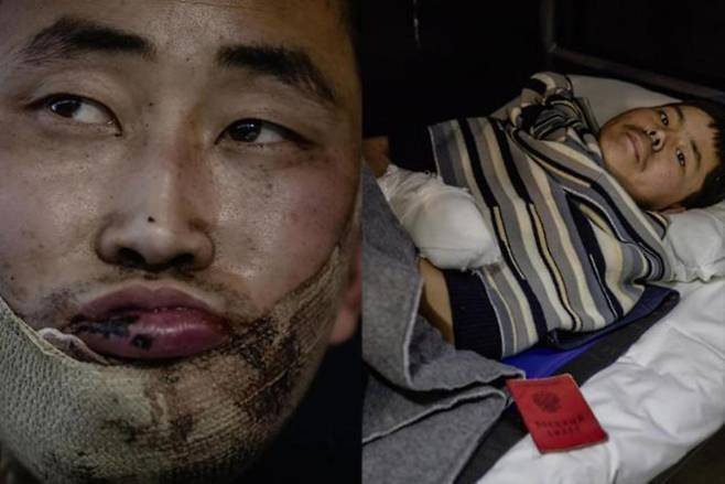 우크라이나군이 생포한 북한군 저격수 정찰장교(왼쪽·26)와 소총수(오른쪽·20)가 키이우 모처에서 치료받고 있다. 지난해 1월 볼로디미르 젤렌스키 우크라이나 대통령이 공개한 사진이다. 젤렌스키 대통령 엑스(X) 화면 캡처