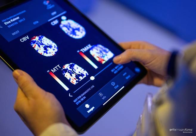 2023년 6월 19일, 베를린 응급병원의 영상의학과 의사가 태블릿의 AI 기반 앱으로 환자의 뇌 영상을 살펴보고 있다. 기사와 무관한 사진. 게티이미지코리아
